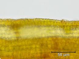 Attēlu rezultāti vaicājumam “Seligeria pusilla sporophyte”