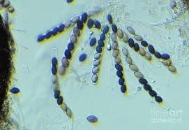 Attēlu rezultāti vaicājumam “Sordaria fimicola”