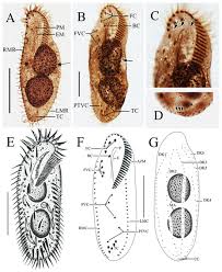 Attēlu rezultāti vaicājumam “Heterotrichia oerstedii (syn. Arcyria oerstedii) stalked”