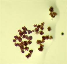 Attēlu rezultāti vaicājumam “Badhamia flavoglauca spores”