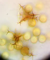 Attēlu rezultāti vaicājumam “Trichia longipalpis spores”