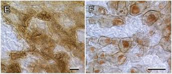 Attēlu rezultāti vaicājumam “Lycogala miserum”