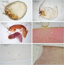 Attēlu rezultāti vaicājumam “Stemonitopsis aequalis var. microspora spores”