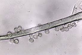 Attēlu rezultāti vaicājumam “Arcyria imperialis”