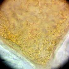 Attēlu rezultāti vaicājumam “Lycogala ustulatum sessile”