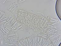 Attēlu rezultāti vaicājumam “Hyalorbilia inflatula”