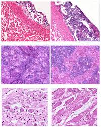 Image result for Huso brevirostrum