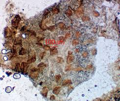 Attēlu rezultāti vaicājumam “Lycogala conicum sessile”