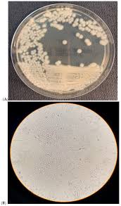 Attēlu rezultāti vaicājumam “Rhabdoweisia fugax sporophyte”