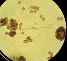Attēlu rezultāti vaicājumam “Stemonitis splendens spores”