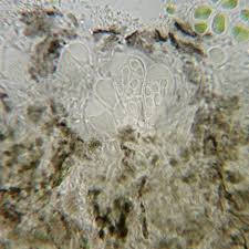 Attēlu rezultāti vaicājumam “Arthonia byssacea”