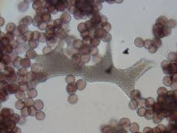 Attēlu rezultāti vaicājumam “Badhamia panicea spores”