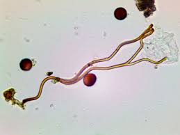 Attēlu rezultāti vaicājumam “Didymium difforme”