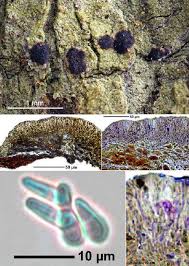 Attēlu rezultāti vaicājumam “Arthonia spadicea”