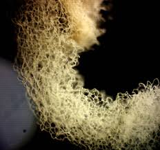 Attēlu rezultāti vaicājumam “Heterotrichia obvelata (syn. Arcyria obvelata) young”