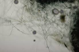 Attēlu rezultāti vaicājumam “Byssocorticium atrovirens”