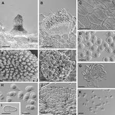 Attēlu rezultāti vaicājumam “Ochropsora ariae spores”