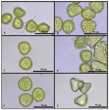 Attēlu rezultāti vaicājumam “Stemonitopsis hyperopta var. landewaldii spores”