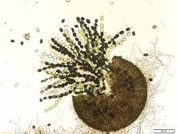 Attēlu rezultāti vaicājumam “Sordaria fimicola”