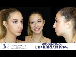 Image result for progenismo