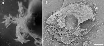 Attēlu rezultāti vaicājumam “Didymium bahiense spores”