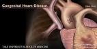 Yale: Congenital Heart Disease