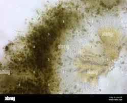 Attēlu rezultāti vaicājumam “Chaenotheca trichialis”