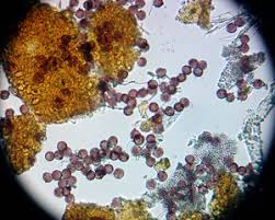 Attēlu rezultāti vaicājumam “Physarum pseudoalexandrowiczii spores”