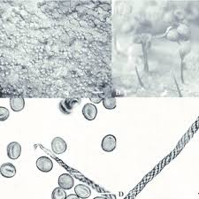 Attēlu rezultāti vaicājumam “Cribraria vulgaris spores”