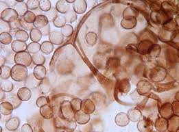 Attēlu rezultāti vaicājumam “Didymium serpula spores”