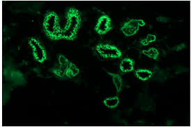 Attēlu rezultāti vaicājumam “Pemphigus borealis”