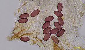 Attēlu rezultāti vaicājumam “Ascobolus furfuraceus”