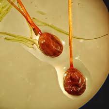 Attēlu rezultāti vaicājumam “Bartramia pomiformis sporophyte”