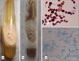 Attēlu rezultāti vaicājumam “Schistidium robustum sporophyte”