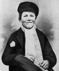 Attēlu rezultāti vaicājumam “Diderma testaceum young”