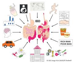 Image result for boala crohn si schizofrenie paranoida