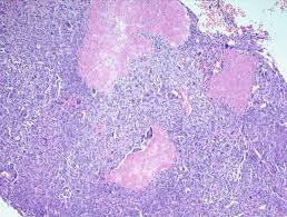 Attēlu rezultāti vaicājumam “Diderma chondrioderma macro”