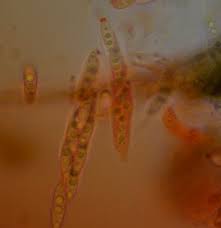 Attēlu rezultāti vaicājumam “Amaurochaete fusiformis macro”