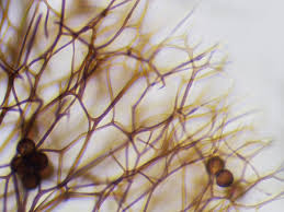 Attēlu rezultāti vaicājumam “Lamproderma echinosporum macro”