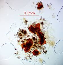 Attēlu rezultāti vaicājumam “Licea minima spores”