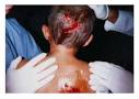 Derry Sinn Fein: MacLochlainn concerned at 60 Dog attack incidents ...