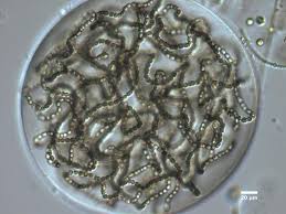 Attēlu rezultāti vaicājumam “Nostoc commune cells”