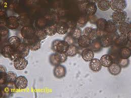 Attēlu rezultāti vaicājumam “Didymium tussilaginis macro”