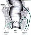 ANAL FİSTÜL / ANAL APSE