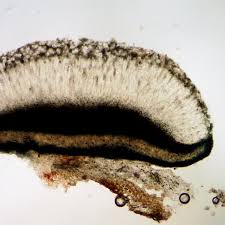 Attēlu rezultāti vaicājumam “Megalaria grossa”