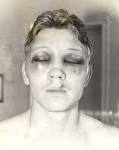 boxers after a fight