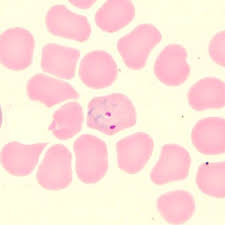 Attēlu rezultāti vaicājumam “Dianema depressum plasmodium”