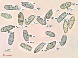 Attēlu rezultāti vaicājumam “Sarcoscypha austriaca var. lutea”