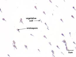 Attēlu rezultāti vaicājumam “Enteridium variabile spores”