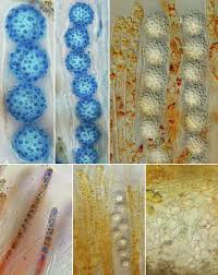 Attēlu rezultāti vaicājumam “Octospora splachnophila spores”